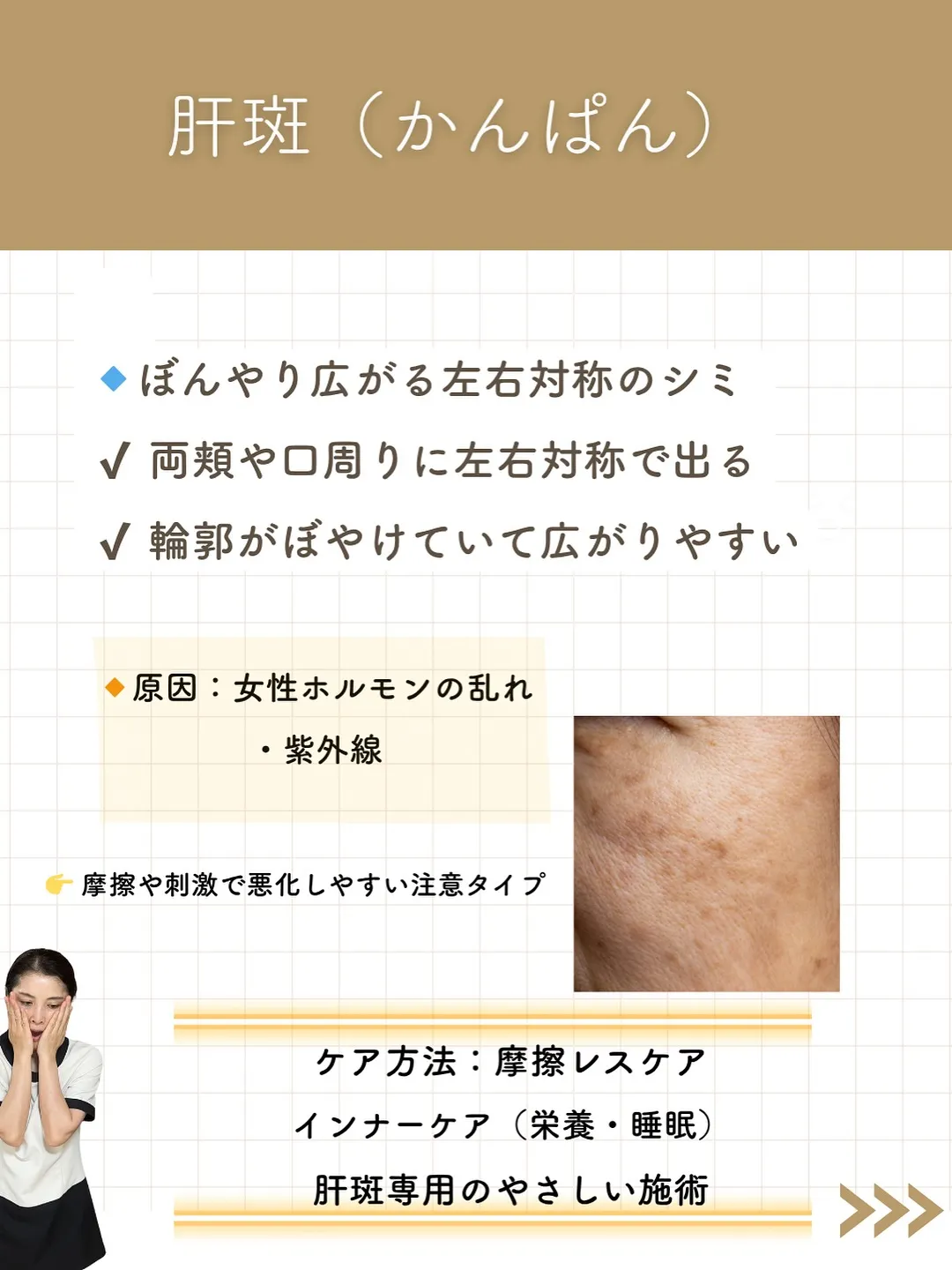 なんとなく気になってたシミ。