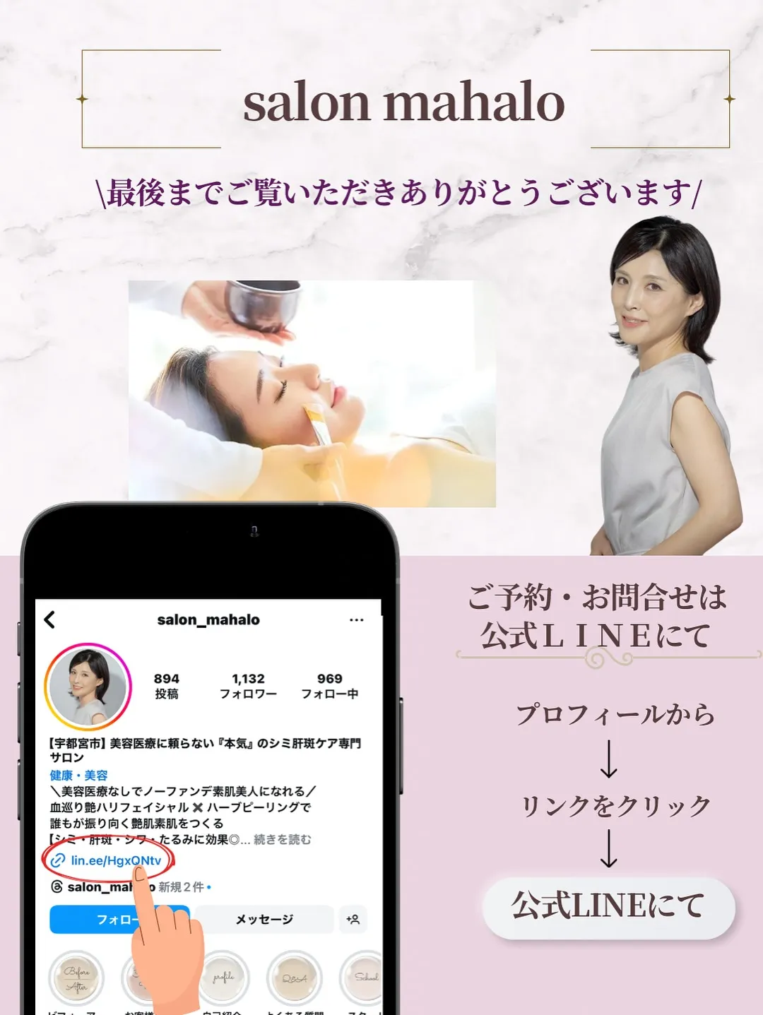 なんとなく気になってたシミ。