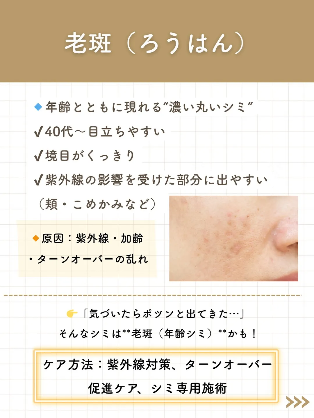 なんとなく気になってたシミ。