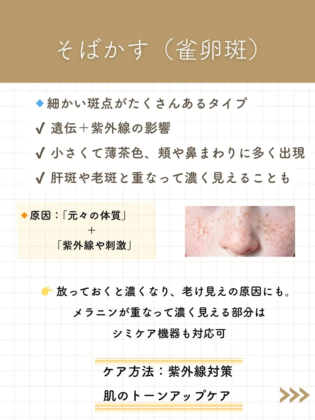 なんとなく気になってたシミ。