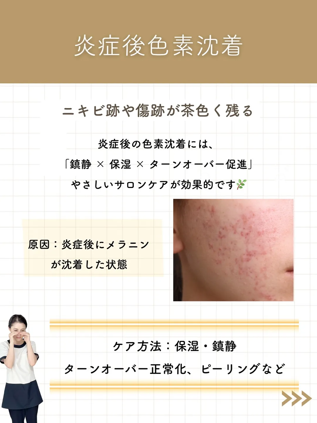 なんとなく気になってたシミ。