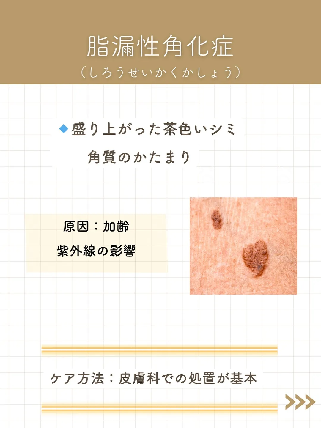 なんとなく気になってたシミ。